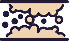 Blutgefäß MIT Einlagerungen